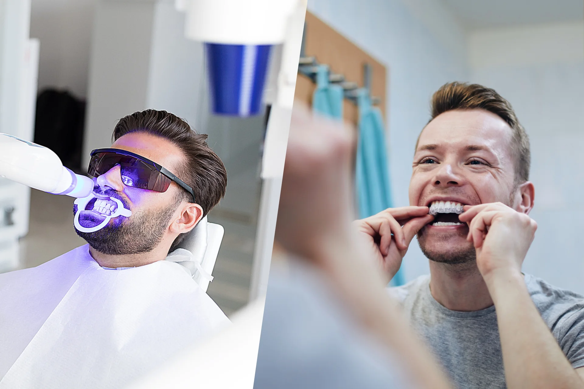 بلیچینگ در مطب یا در خانه؟